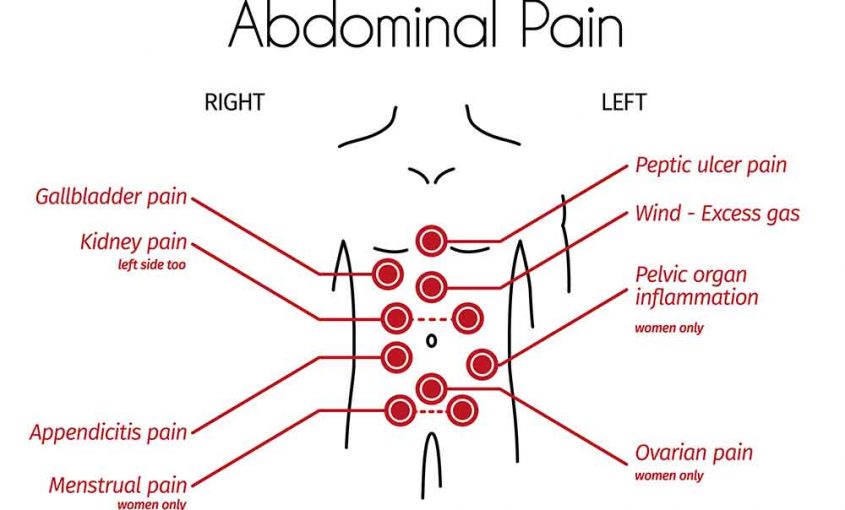 Abdominal Pain: Everything You Need to Know About Abdominal Pain