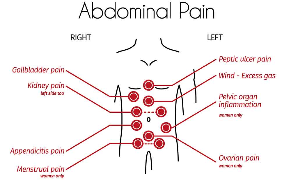 Dolor abdominal: todo lo que necesita saber sobre el dolor abdominal