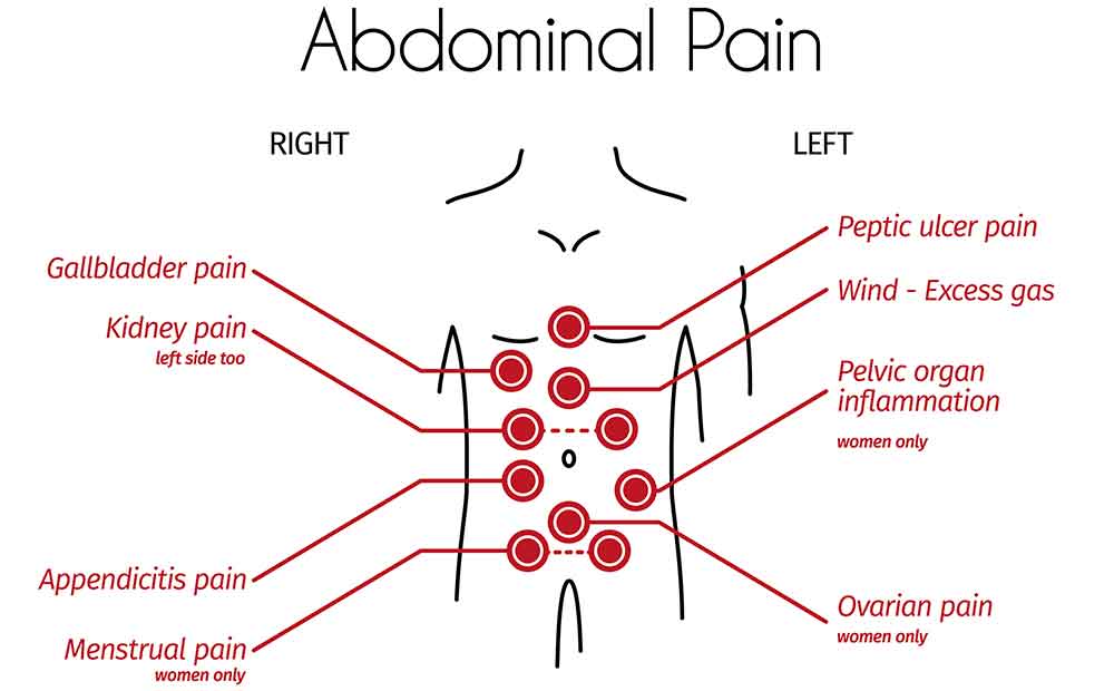 Abdominal Pain: Everything You Need to Know About Abdominal Pain