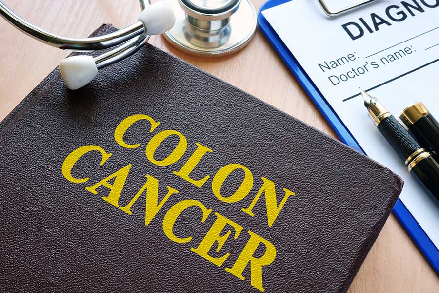 Ways to Reduce Your Risk of Colon Cancer