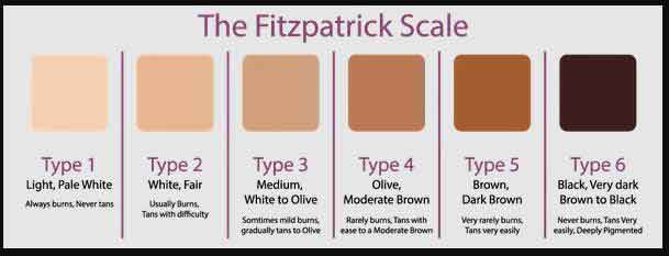 fitzpatrick sunburn scale