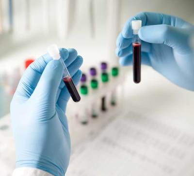 Lab Test Now Lab Tests at enTrust Urgent Care Center Clinic & Walk-in Clinic